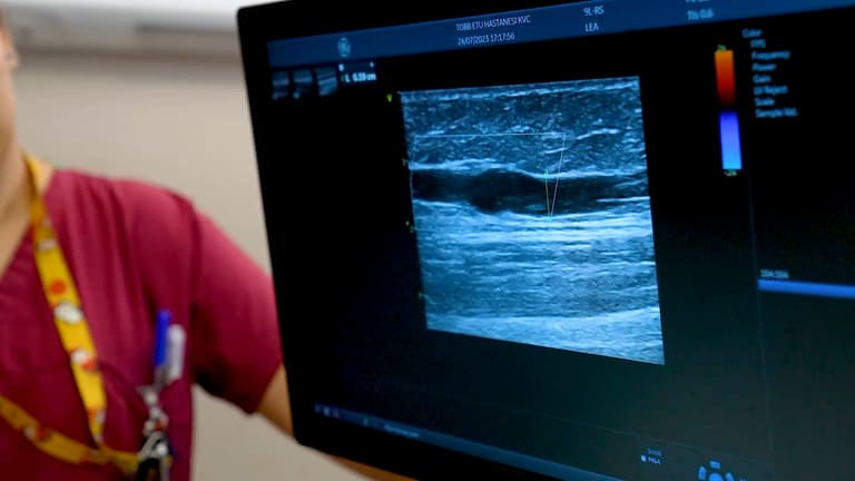 A vein shown on the ultrasound screen